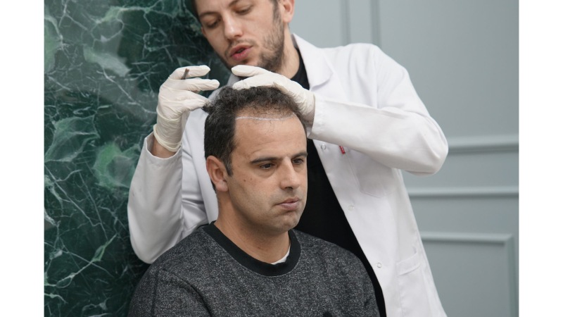 The Life-Changing Benefits of Hair Transplants You Can’t Ignore