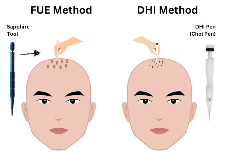 Advanced Techniques for Seamless Hairlines