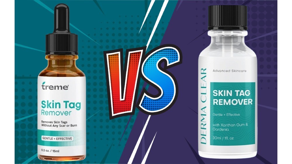 Treme Skin Tag Remover vs. Derma Clear